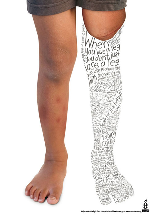 Amnesty International