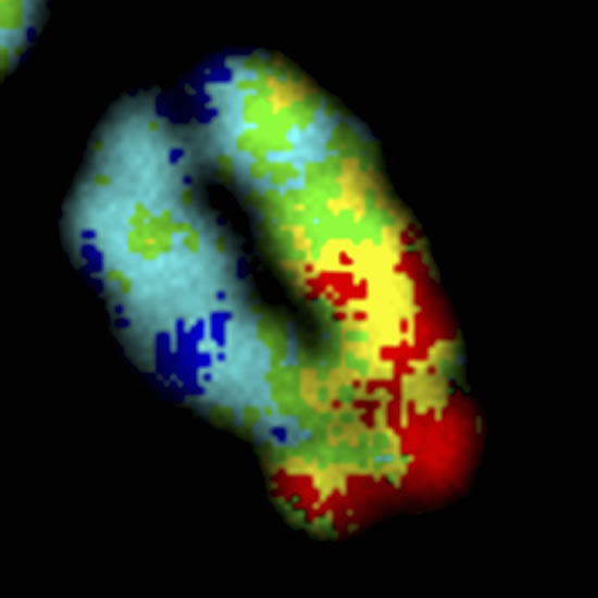 fotografias_ganadoras_wellcome_2011_David Lleres_cromosoma_humano fotografias_ganadoras_wellcome_2011_David Lleres_cromosoma_humano