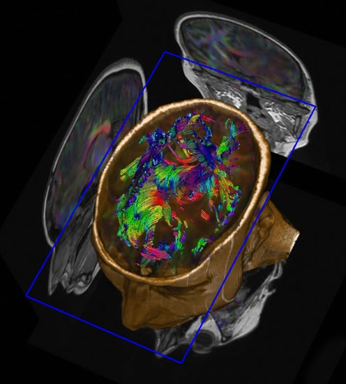fotografias_ganadoras_wellcome_2011_vias_neuronales_cerebro_nuada fotografias_ganadoras_wellcome_2011_vias_neuronales_cerebro_nuada